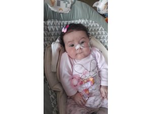 EFLİN LİNA'YI YAŞATALIM